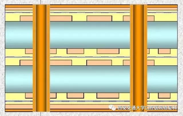PCB钻孔示意图